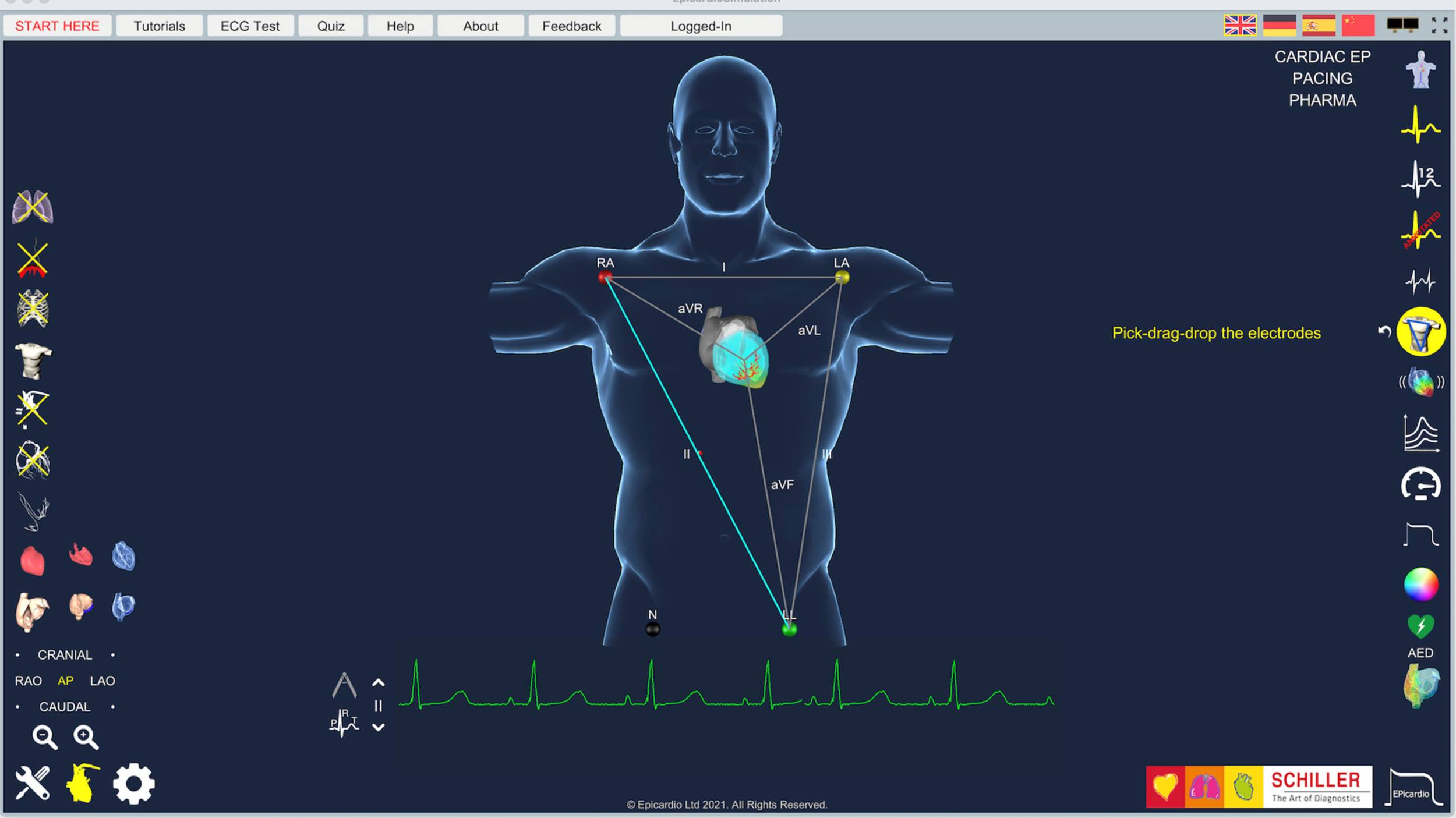 Epicardio ECG Simulation, Cardiac Axis | © Epicardio